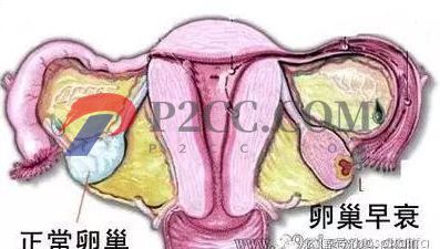 女人做了試管嬰兒人就廢了？好可怕，真的嗎？(圖2)