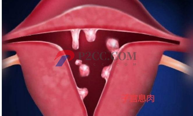 排卵期性腹痛和出血是怎么回事，需不需要治療？(圖2)