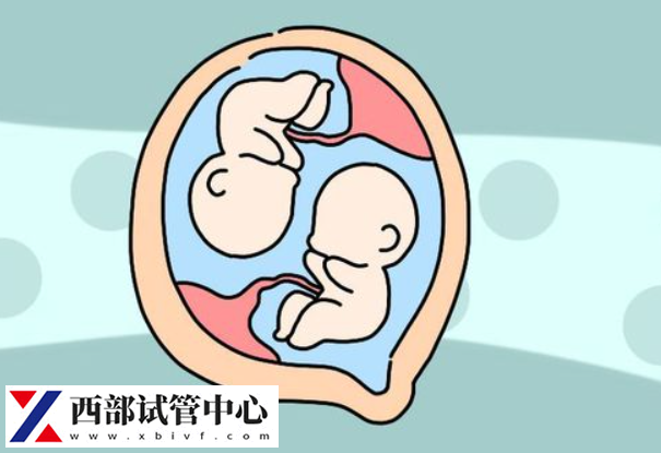 雙胞胎流產(chǎn)的風(fēng)險略高于單胎