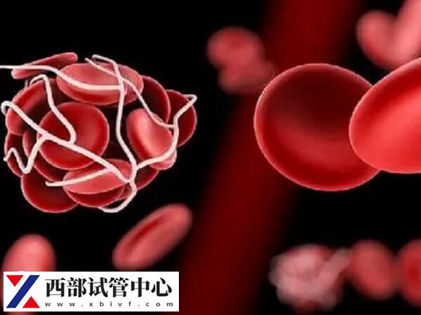 長(zhǎng)期臥床容易形成靜脈血栓